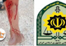 Sna; A citizen was shot by police forces